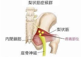 梨 状 筋 作用